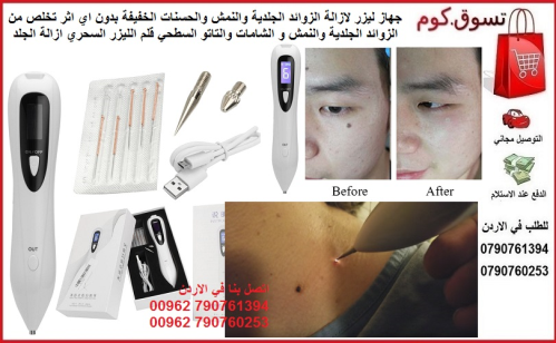 طريقة علاج الزوائد الجلدية بالليزر  في الأردن