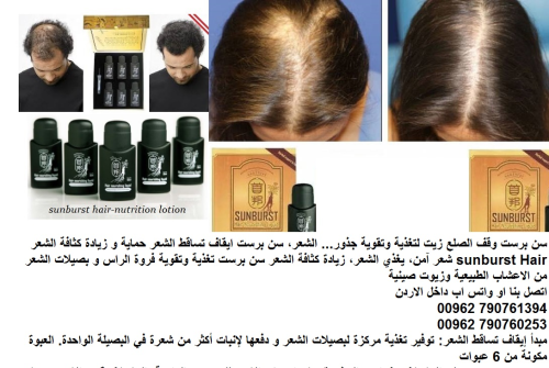 علاج تساقط الشعر |  اعادة نمو الشعر في الأردن