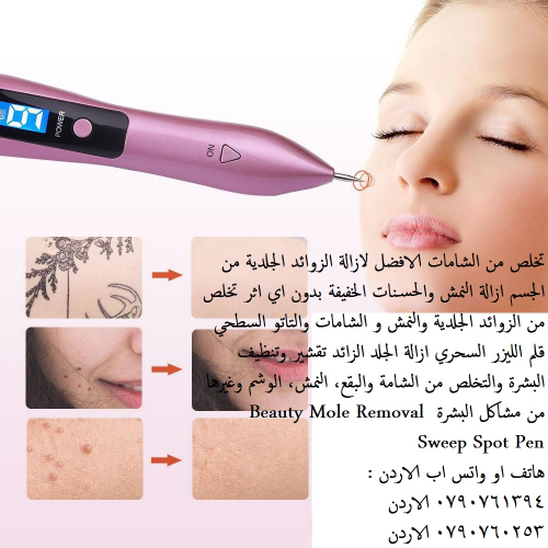 جهاز طبي ازالة زوائد الجلد و نمش الوجه يمكن علاج النمش وتجديد الجلد بواسطة استخدام أجهزة تخلص من الن