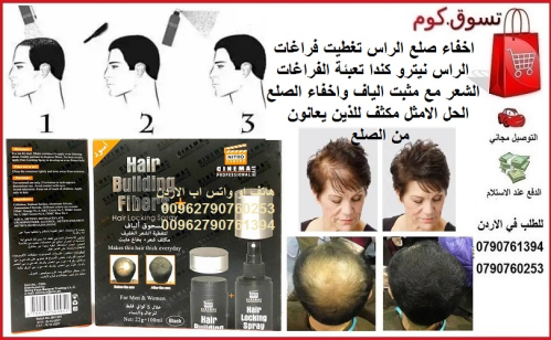 مشكلة فقدان الشعر اخفاء صلع الراس ت في الأردن
